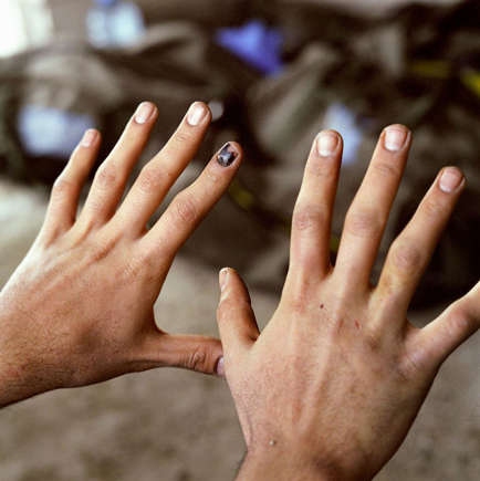 Fingernail mark 