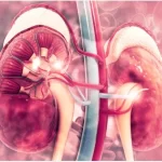 kidney Disease: causes and prevention